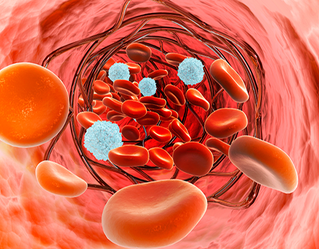 動脈粥樣硬化斑塊、硬塊、身體-康興醫(yī)療器械官網(wǎng)